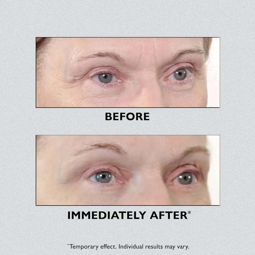 InstaLift Pro - for instant eye lift & wrinkle defense